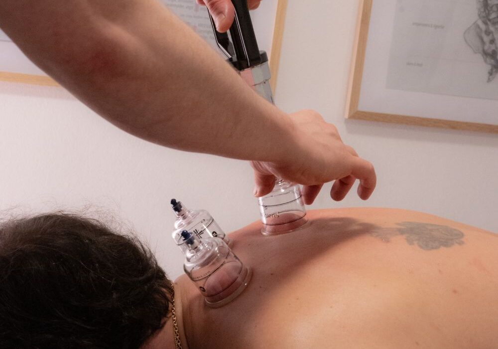 din-cupping-specialist-i-lyngby